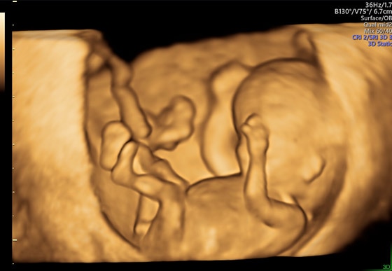 voluson-performance-p8_s-curve-module_image1