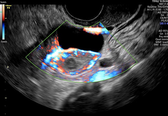 voluson-performance-p8_s-curve-module_image3