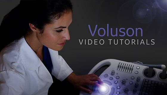 voluson-performance-p8_s-curve-module_image4