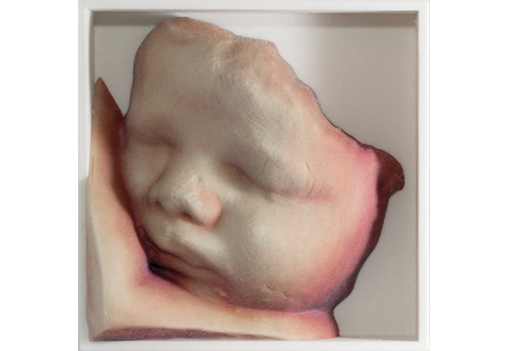 voluson-s8-signature-series-ge-s-curve-3d-images-further-with-3d-printing