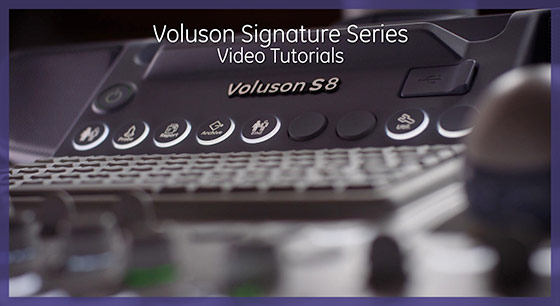 voluson-s8-signature-series-ge-s-curve-educational-videos