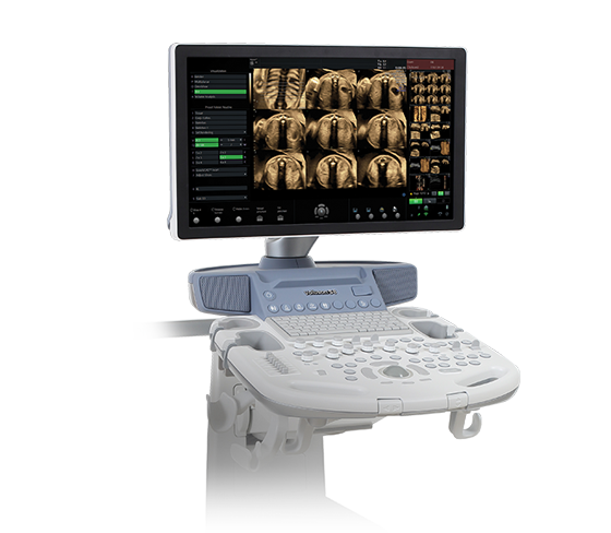 voluson-s8-signature-series-ge-s-curve-widescreen-23-monitor