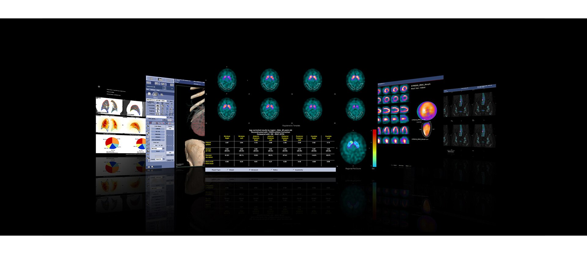 GEHCXeleris4DRAdditionalApplicationsImage1v1