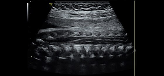 Изображение позвоночника 26-недельного плода