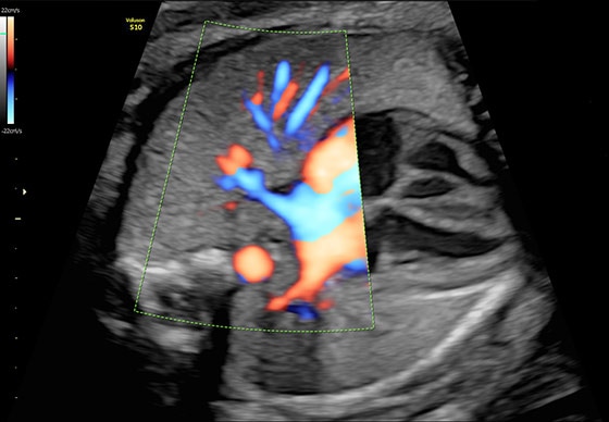 voluson-s10-ge-s-curve-3d-images-2d-image