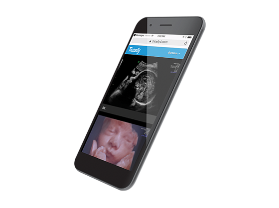 voluson-s10-ge-s-curve-tricefy-inside