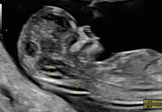 voluson-s10-ge-s-curve-voluson-s-sono-automation