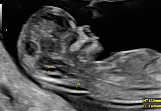 voluson-s10-ge-s-curve-voluson-s-sono-automation