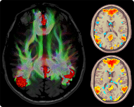 product-product-categories-magnetic-resonance-imaging-signa premier-fmri.png