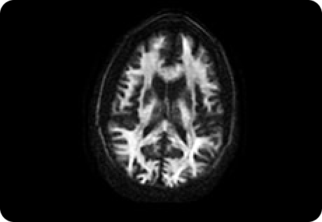 product-product-categories-magnetic-resonance-imaging-signa premier-Image2.png