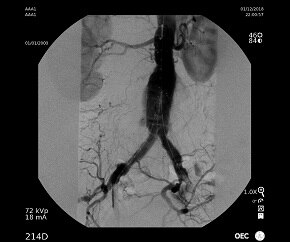 OECEliteCFDAAAAngio-290