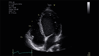 Виртуальный апекс