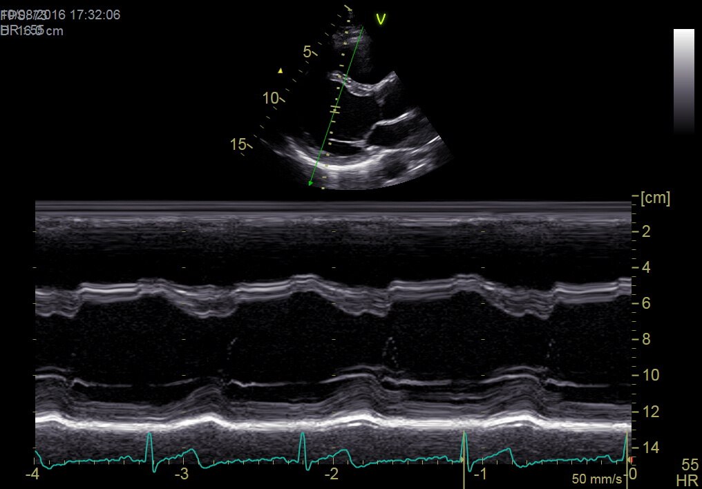 Анатомический М-режим