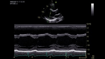 Анатомический М-режим
