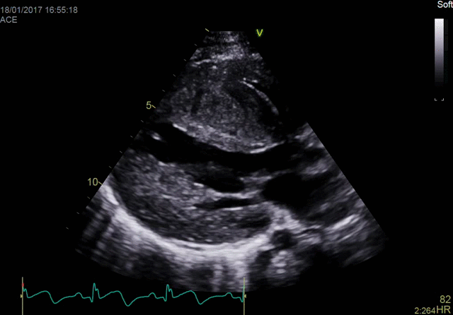 Виртуальный апекс