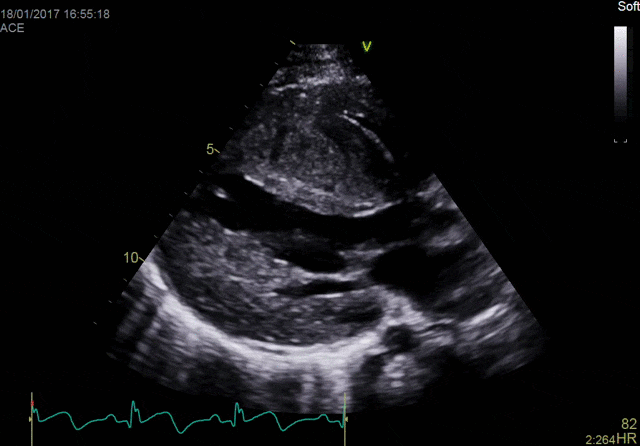 Виртуальный апекс