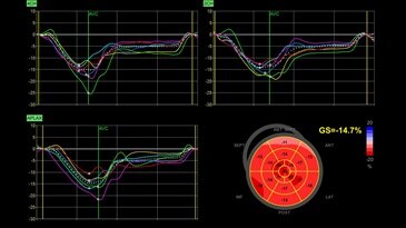 Автоматическая функциональная визуализация (AFI) 2.0*