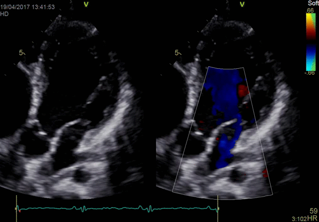 Цветовая допплерография взрослых пациентов