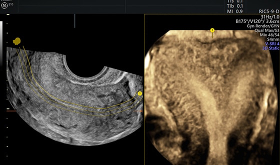 Advanced-Volume-Contrast-Imaging