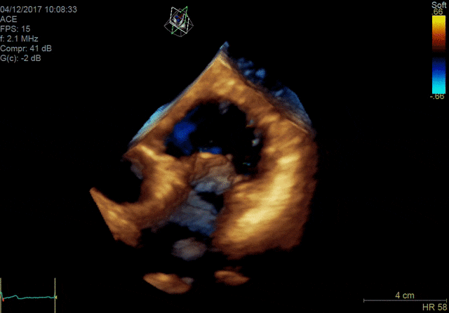 Цветная 4D-визуализация с применением датчика 4Vc-D