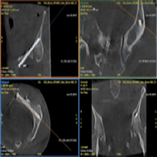 bone-interventional-assess.png