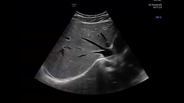 Прикорневой срез печени