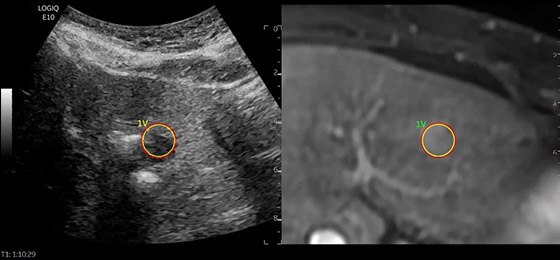 logiq-e10-ge-ultrasound_s-curve_case03_small