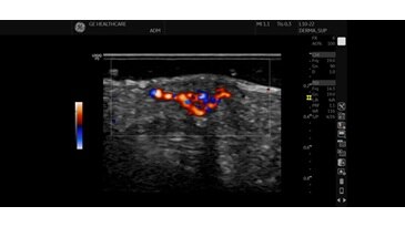 Дерма PDI, L10-22-RS