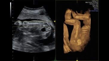 Скелетный режим, технология Advanced VCI с Omniview