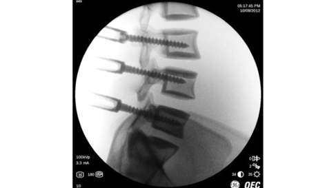 Функция Smart Metal 1