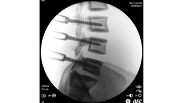 Функция Smart Metal 1