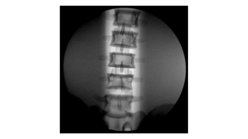 Функция Auto window 1