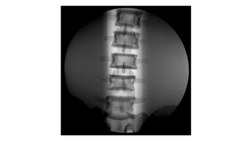 Функция Auto window 1