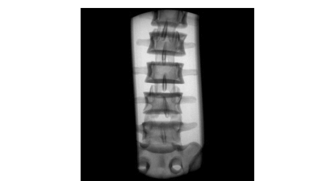 Функция Auto window 2