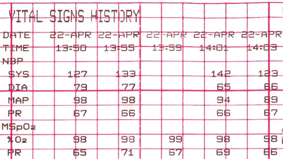 hotspottours-mic-corometrics250cx-gehc-corometrics-250cx-hotspot-4
