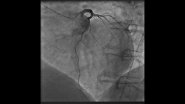 Приложение InnovaSpin